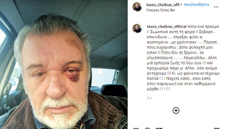 Ο Τάσος Χαλκιάς τρόμαξε τους θαυμαστές του με την φωτογραφία που ανέβασε χθες στον λογαριασμό του στο Instagram, καθώς φαίνεται με «μαυρισμένο» μάτι ενώ διακρίνονται και γρατζουνιές στο μέτωπό του.