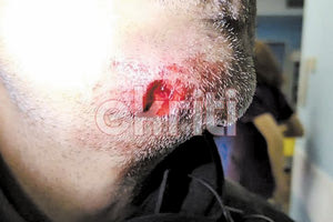 ΑΠΙΣΤΕΥΤΟ ΠΕΡΙΣΤΑΤΙΚΟ Δάγκωσε τον αστυνομικό!