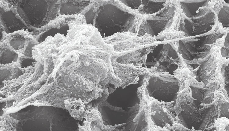 Η ImmunoRec έχει στόχο να αναπτύξει εξατομικευμένα εμφυτεύσιμα εμβόλια