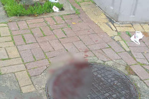 Η άτυχη γυναίκα τραυματίστηκε σοβαρά