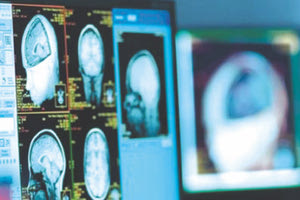 επιστήμονες κατέγραψαν τι συμβαίνει στον εγκέφαλο τη στιγμή που ο άνθρωπος πεθαίνει