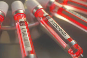 Στο θέμα της αναγκαιότητας λειτουργίας του έχει αναφερθεί και η “Π”