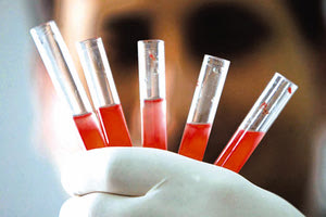 ομάδα αίματος