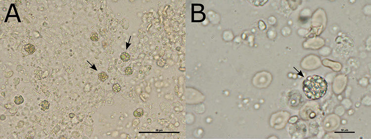 Νωπό παρασκεύασμα ξέσματος βραγχίων από τους κεφάλους του Αποσελέμη, όπως παρατηρήθηκε σε οπτικό μικροσκόπιο. Εντοπίστηκε μεγάλος αριθμός κυττάρων του ιχθυοτοξικού μικροφύκους, Chattonella sp. (βέλη). A. Μεγέθυνση 400x. B. Μεγέθυνση 1000x