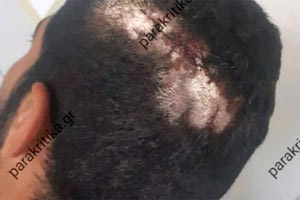 Χτυπήματα στο κεφάλι φέρει ο Αιγύπτιος σύμφωνα με την φωτογραφία από τα parakritika.gr