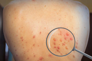 ευλογια των πιθηκων