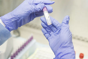 COVID ΚΡΟΥΣΜΑΤΑ