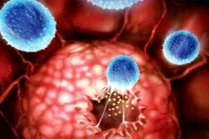 αυτοάνοσες παθήσεις