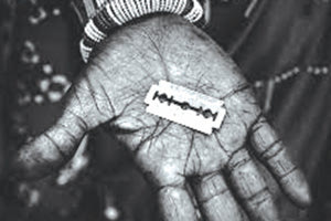 Παγκόσμιος Οργανισμός Υγείας: Επιβλαβής μη ιατρική παραδοσιακή πρακτική που έχει μακρόχρονες συνέπειες για την υγεία