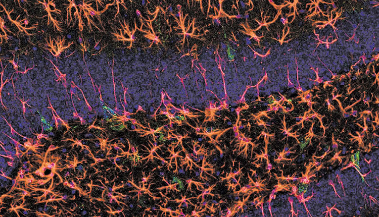 Η ομάδα του καθηγητή Γραβάνη προσπαθεί να καταπολεμήσει το Alzheimer