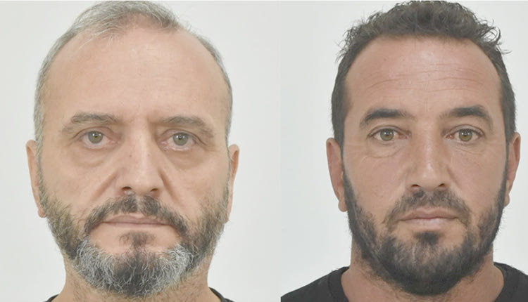 Στη δημοσιότητα δόθηκαν από την ΕΛ.ΑΣ με εισαγγελική παραγγελία τα στοιχεία ταυτότητας του 53χρονου βιαστή και μαστροπού της 12χρονης, Ηλία Μίχου, και του 43χρονου Γιάννη Σοφιανίδη ο οποίος είναι μεταξύ αυτών που έχουν βιάσει την ανήλικη. Στο πλαίσιο αυτό, παρακαλούνται οι πολίτες να επικοινωνούν με τους τηλεφωνικούς αριθμούς 210-6476370 της Υποδιεύθυνσης Προστασίας Ανηλίκων και 210-6411111 της Διεύθυνσης Ασφάλειας Αττικής, για την παροχή οποιασδήποτε σχετικής πληροφορίας. Σημειώνεται ότι διασφαλίζεται η ανωνυμία και το απόρρητο της επικοινωνίας