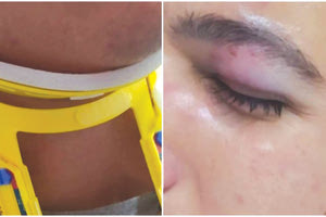 Ο 17χρονος μεταφέρθηκε στο νοσοκομείο όταν του παρασχέθηκαν οι πρώτες βοήθειες