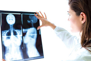 Είναι ο συχνότερος καρκίνος στις γυναίκες, λέει στην “Π” ο διευθυντής της κλινικής Χειρουργικής Ογκολογίας του ΠΑΓΝΗ καθηγητής κ. Έλκο Ντε Μπρε