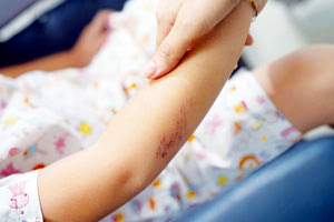 δομή παιδιών και ενηλίκων με αναπηρία