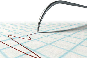 ΣΕΙΣΜΟΓΡΑΦΟΣ