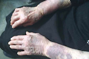 O θάνατο της ηλικιωμένης μετά την ληστεία στη Ζήρο Σητείας