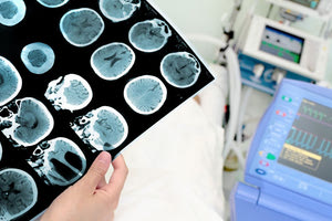 Εξαιρετικά σημαντική η μεταφορά του ασθενούς στο νοσοκομείο στις πρώτες 4-6 ώρες του επεισοδίου, σύμφωνα με τον καθηγητή Νευρολογίας και διευθυντή της Νευρολογικής Κλινικής του ΠΑΓΝΗ κ. Παναγιώτη Μήτσια