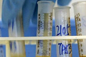 ντόπινγκ - κοντρόλ