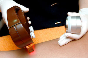 αποτρίχωση