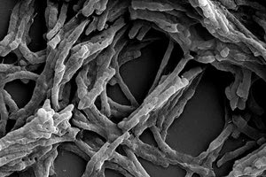 Το ένζυμο Huc είναι μία «φυσική μπαταρία» που μετατρέπει τον αέρα σε ηλεκτρική ενέργεια