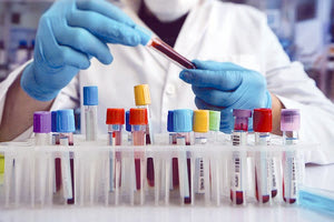 Ο Πανελλήνιος Φαρμακευτικός Σύλλογος κατήγγειλε και τις μεγάλες ελλείψεις φαρμάκων για τον έλεγχο του σακχαρώδους διαβήτη τύπου 2