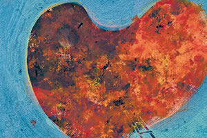 Σημαντική η πρόληψη για την καρδιακή ανεπάρκεια