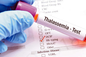 ΘΑΛΑΣΣΑΙΜΙΑ