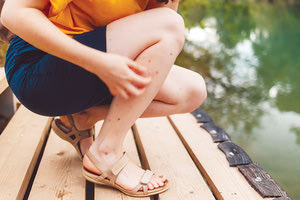 Τα κουνούπια ελκύουν αρώματα λουλουδιών, αποστρέφονται όμως τη μυρωδιά της καρύδας