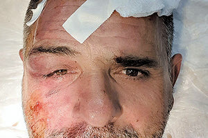 Ο ξυλοδαρμός εργαζομένου σε κατάστημα Αγίου Νικολάου