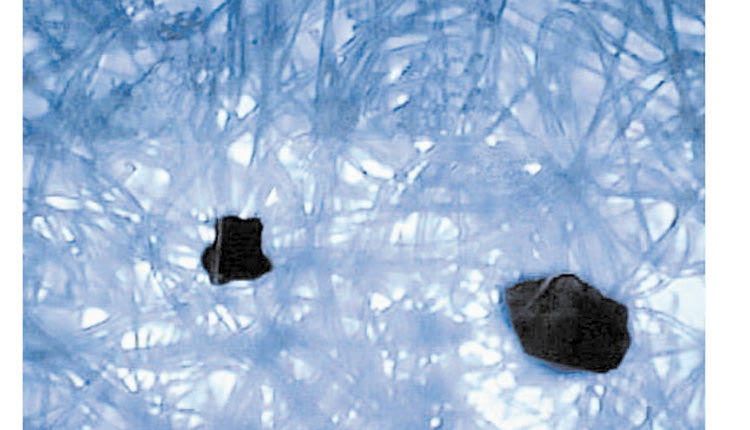 Εικόνα 2: Μεγέθυνση του υφάσματος. Διακρίνονται κόκκοι άμμου που έχουν συγκρατηθεί (OSI, 2001).
