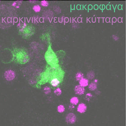 (Αριστερά) Εικόνα που απεικονίζει τομή μιας μύγας –ξενιστή η οποία φέρει νευρικό όγκο. Λίγα καρκινικά κύτταρα εγκεφάλου ενέθηκαν στην κοιλιά της μύγας. Δεκατέσσερις μέρες αργότερα έχουν επεκταθεί σε όλο της το σώμα, φτάνοντας μέχρι και το κεφάλι. Τα μακροφάγα  και τα καρκινικά κύτταρα συχνά γειτνιάζουν και αλληλοεπιδρούν. 
(Δεξιά)  Μακροφάγα καταβροχθίζουν και αποικοδομούν καρκινικά νευρικά κύτταρα.   