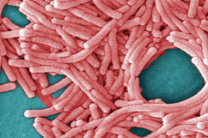 Συναγερμός στην Πολωνία για τη νόσο των λεγεωνάριων -3 νεκροί και 71 στο νοσοκομείο