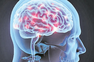 Με την αντιμετώπιση 12 παραγόντων κινδύνου θα μπορούσε να μειωθεί το 40% των περιπτώσεων άνοιας