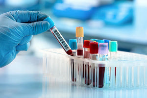 “Στα κάγκελα” και οι εργαστηριακοί γιατροί της Κρήτης που λένε ότι οδηγούνται στη χρεοκοπία