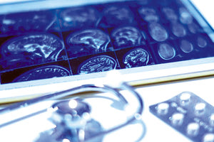 ΚΑΙ ΤΟ ΠΑΓΝΗ Δίκτυο για τα... εγκεφαλικά