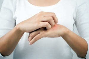 Έχουν διαγνωστεί και διερευνηθεί συνολικά 157 εγχώρια κρούσματα λοίμωξης