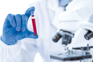 Μόνο στο εξωτερικό εξειδικευμένες εξετάσεις που κάνει η Αιματολογική Κλινική του ΠΑΓΝΗ