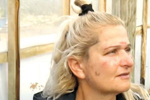 Το θύμα της επίθεσης του 32χρονου με εμφανή τα σημάδια στο πρόσωπο και στο σώμα, όπως εμφανίστηκε την επομένη της απόπειρας