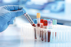 Το 40% των καρκίνων μπορούν να προληφθούν και να διαγνωστούν πρώιμα