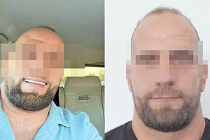 Τέσσερις ώρες πριν την εν ψυχρώ δολοφονική επίθεση σε βάρος των τριών νεαρών από τα Μάλια, αστυνομικοί της ΔΙ.ΑΣ είχαν ελέγξει τον 37χρονο “πιστολέρο”, ο οποίος αποχώρησε σαν... κύριος. Και αυτό προκαλεί πλήθος ερωτηματικών. Τελικά ο 37χρονος βρίσκεται στο σύστημα καταζητήσεων ή κυκλοφορεί με πλαστά έγγραφα; Υποβλήθηκε σε σωματικό έλεγχο ή όχι; 