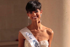 Τη στοχοποίησαν επειδή κέρδισε τα καλλιστεία με κοντό μαλλί!