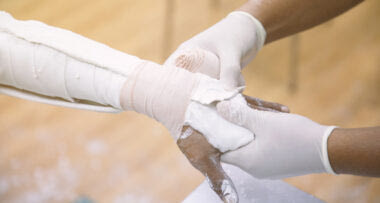 Έτσι έγινε το φοβερό ατύχημα που τραυμάτισε τον 62χρονο στο χερι όταν πήγε να φουσκώσει ένα λάστιχο- Τι λέει ο ίδιος στην “Π” μέσα από το Βενιζέλειο όπου νοσηλεύεται