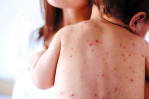 Από 941 κρούσματα το 2022 φτάσαμε τα 30.000 πέρυσι