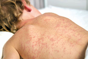 Αυξάνονται τα κρούσματα