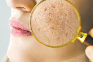 Σε ποια προϊόντα ανιχνεύτηκαν οι επικίνδυνες ουσίες