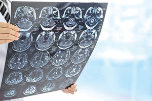 Χωρίς παιδονευρολόγο τα νοσοκομεία, ενώ πάρα πολλά παιδιά τον χρειάζονται