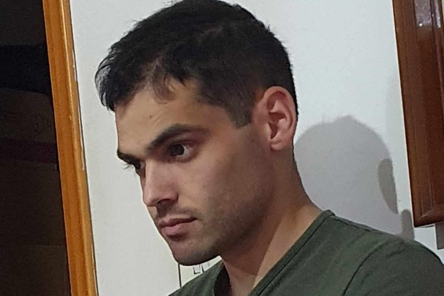 Επανατοποθέτησαν το οστό στο κεφάλι του Νίκου μετά τη σφαίρα