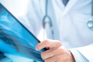 Παραιτήθηκε μια ακόμη ακτινολόγος απο το Βενιζέλειο και ετοιμάζεται κι άλλος!