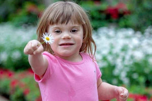 Σύνδρομο Turner: Τι είναι και γιατί εμφανίζεται στα κορίτσια