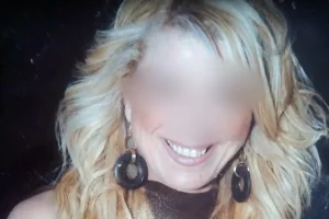 Νεκρή κομμώτρια στην Πάτρα: Και δεύτερη γυναίκα πέθανε μετά από λιποαναρρόφηση στον ίδιο γιατρό